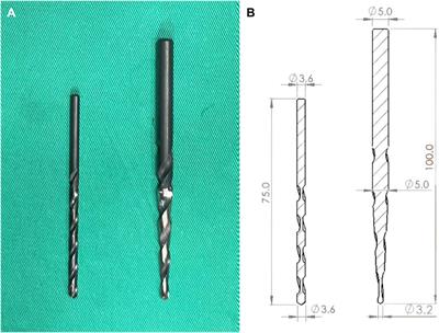 Biomechanical evaluation of pedicle screw stability after 360-degree turnback from full insertion: effects of screw shape, pilot hole profile and bone density